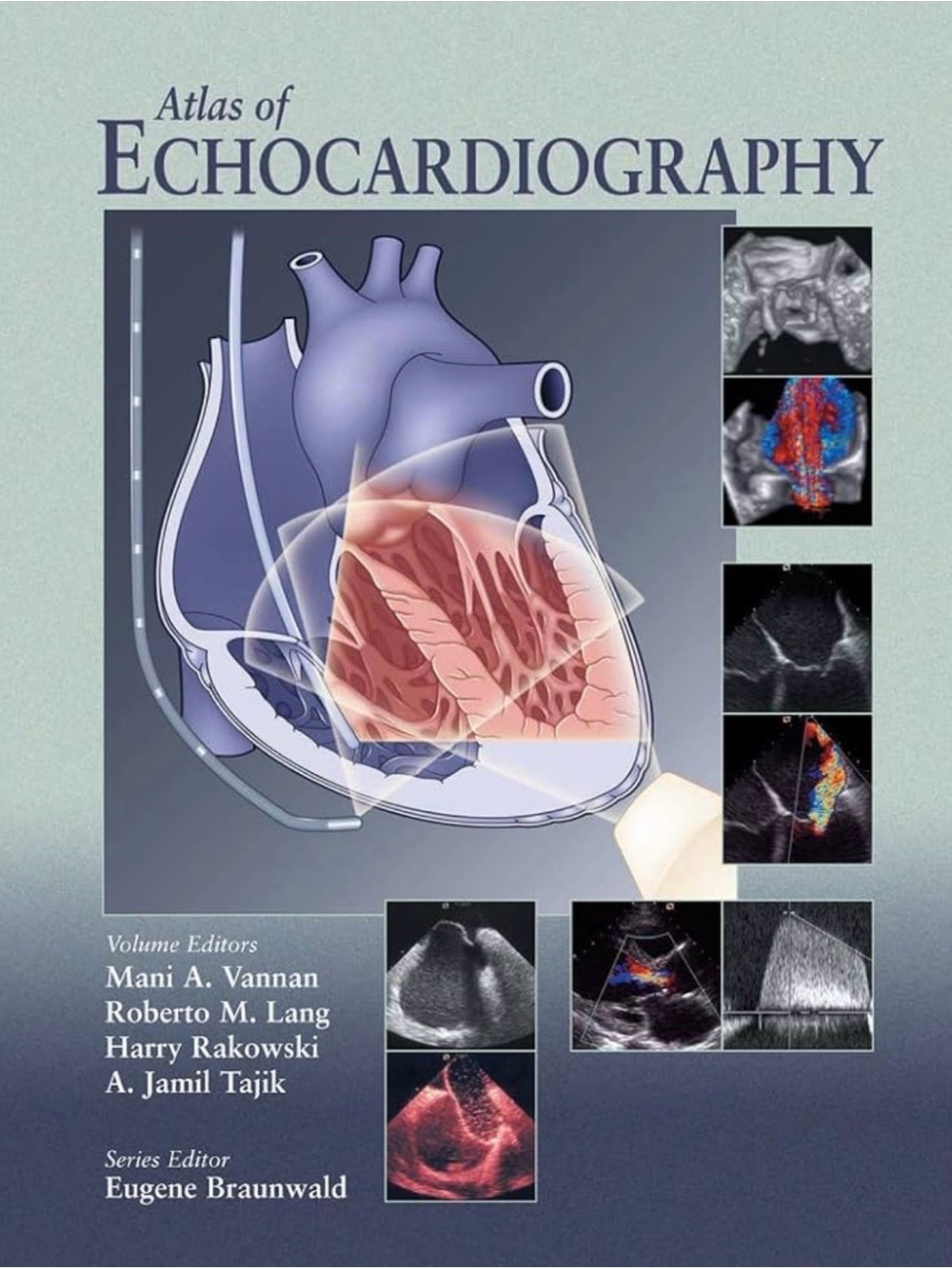 Atlas of Echocardiography - Blue Cover